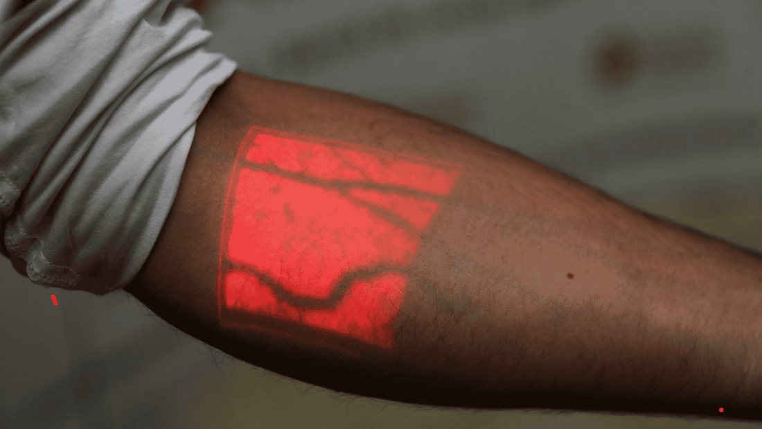 Why Injections and Blood Draws Are Done in Veins Instead of Arteries